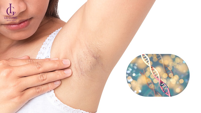 tại sao lông nách mọc ít