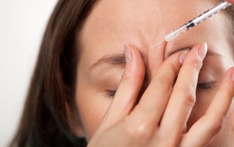 tiêm botox xoá nhăn cau mày