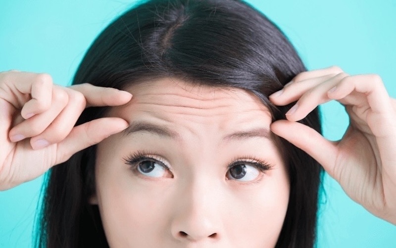 nếp nhăn vùng trán