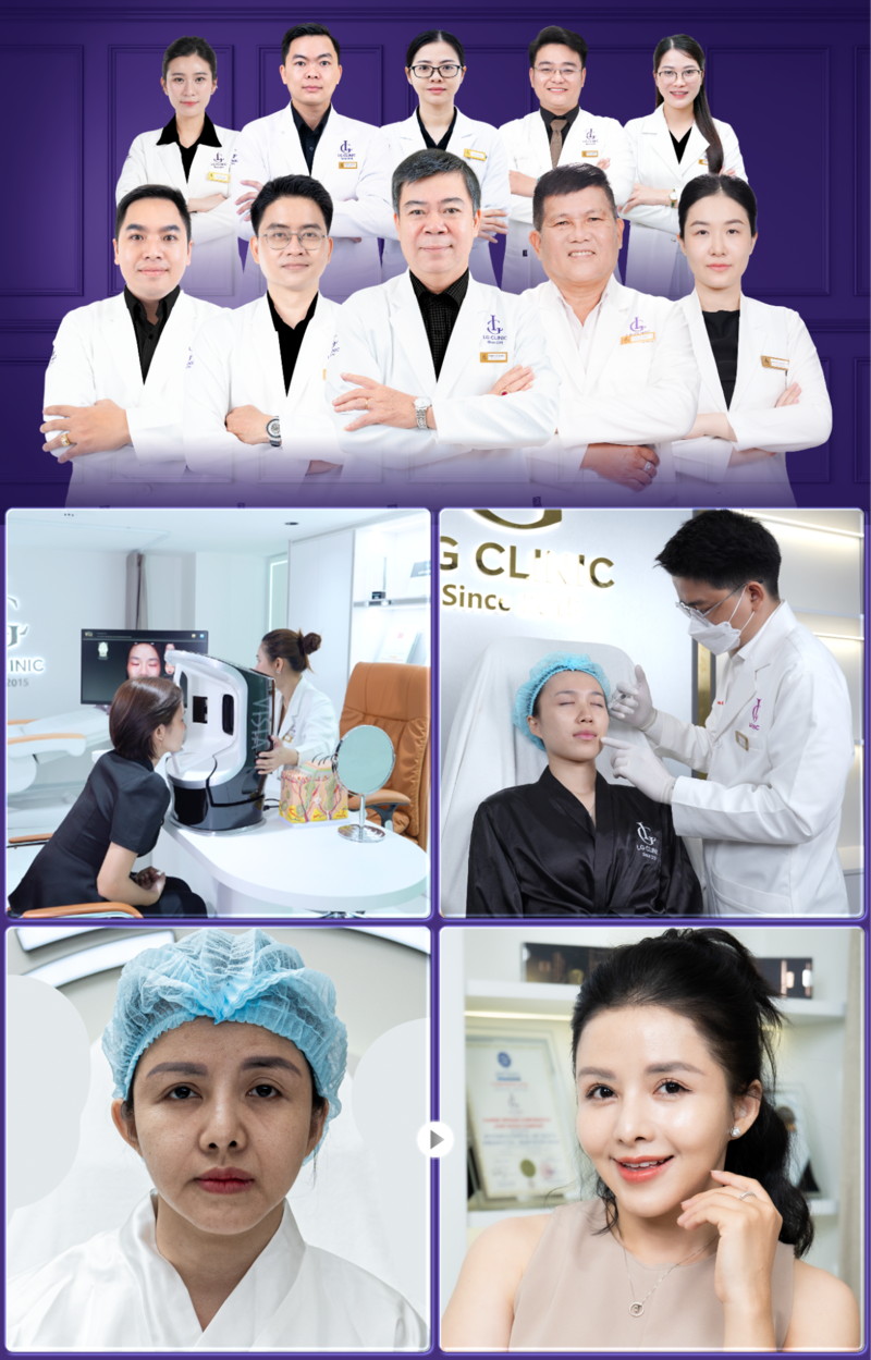 lg clinic xoá nhăn rãnh cười