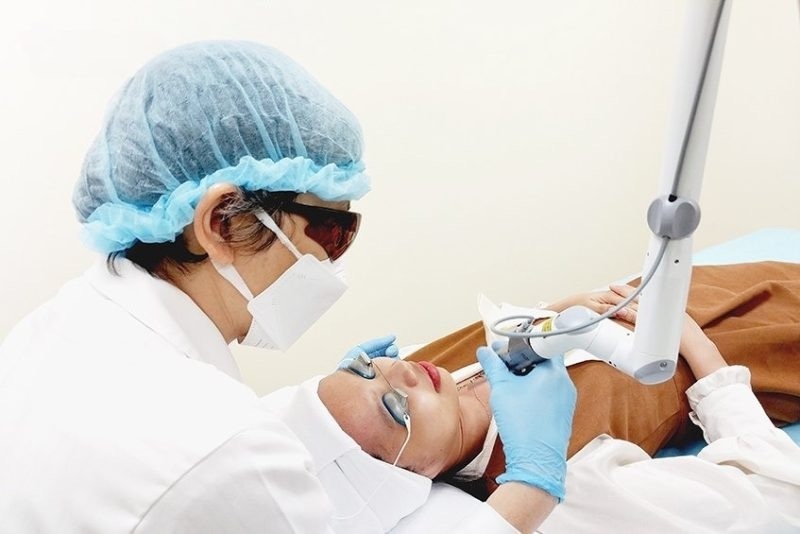 bắn laser vùng cổ