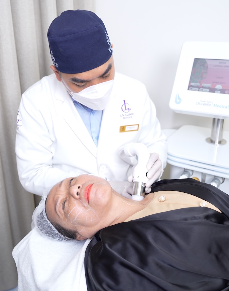 xoá nếp nhăn cổ bằng công nghệ cfu