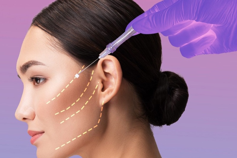 căng chỉ sinh học