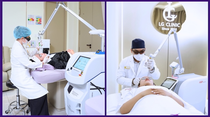 bắn laser trẻ hoá da