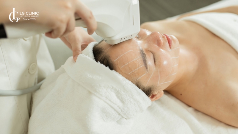Xoá nhăn cau mày bằng công nghệ HIFU