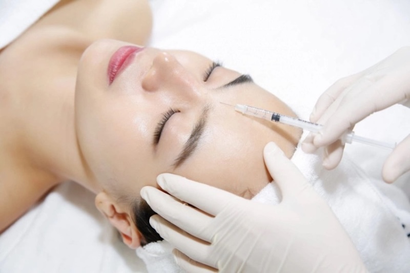 tiêm botox xoá nhăn ấn đường