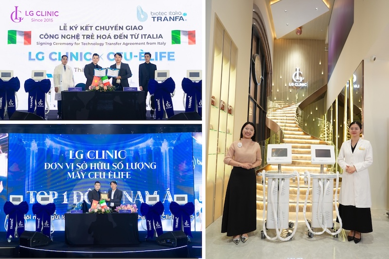 lg sở hữu máy cfu nhiều nhất đông nam á