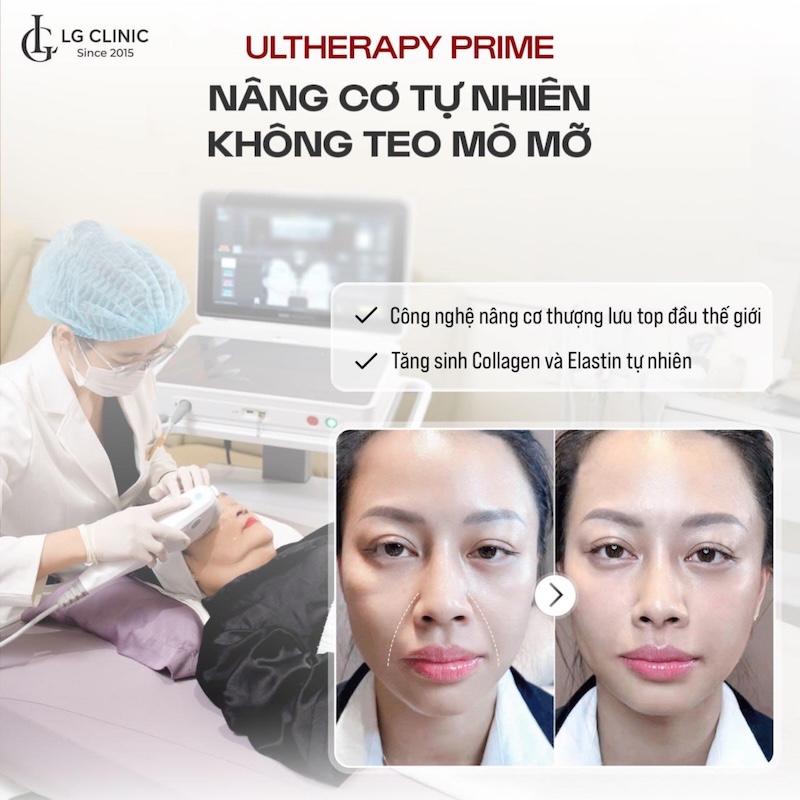 xoá nhăn nâng cơ ultherapy prime