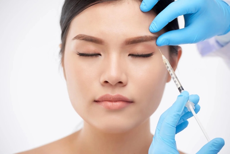 tiêm botox xoá nếp nhăn vùng mắt