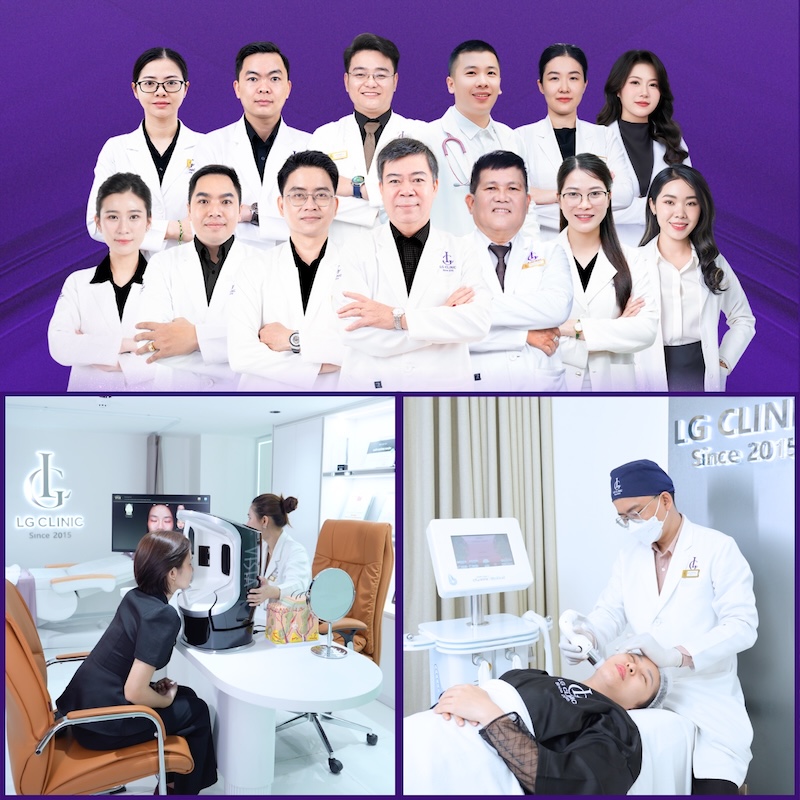 xóa rãnh cười tại lg clinic