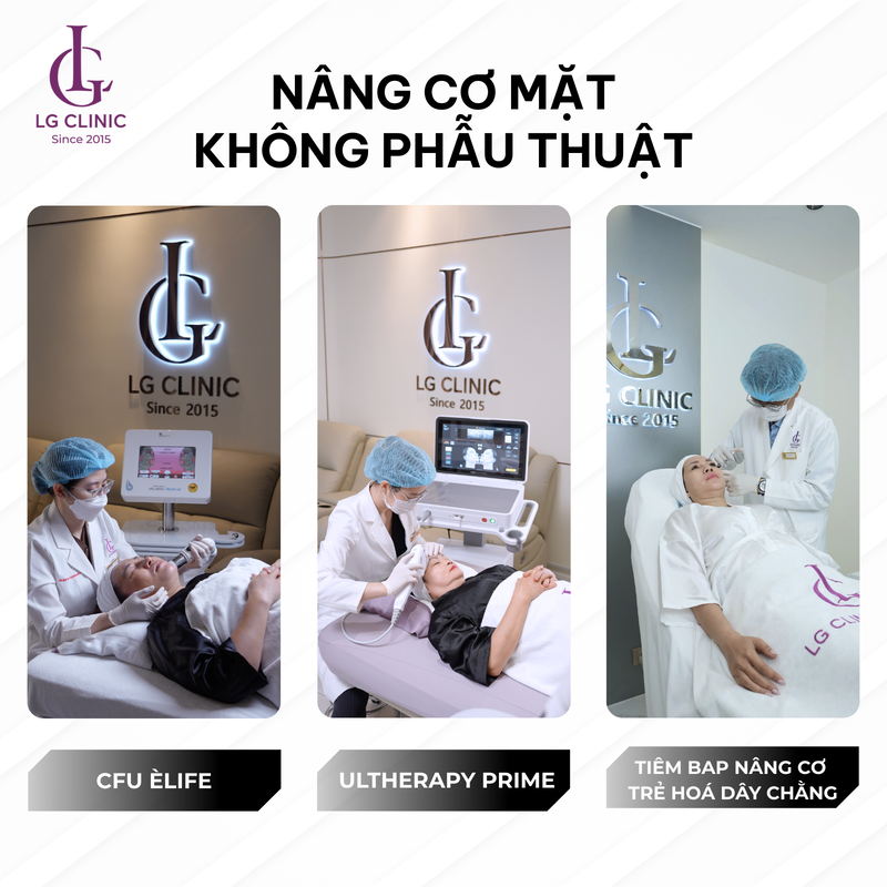 giá xoá rãnh cười phụ thuộc phương pháp điều trị