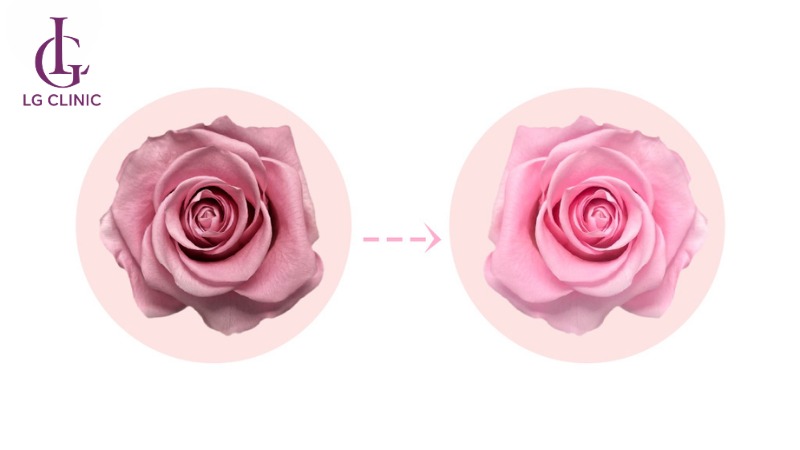 Cách làm hồng nhũ hoa bằng mật ong