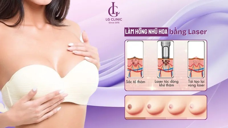 Cách làm hồng nhũ hoa bằng mật ong