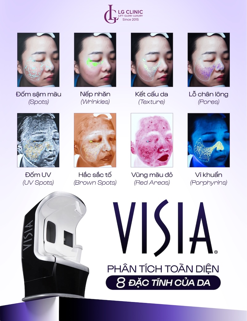 máy soi da visia