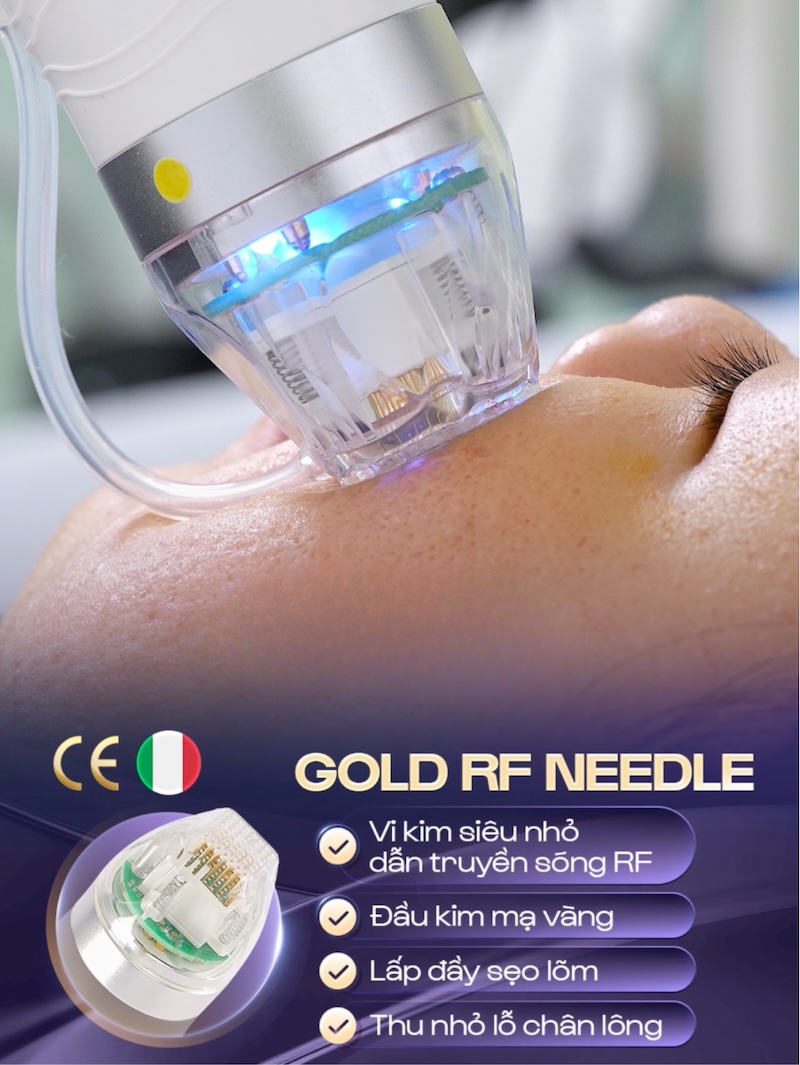 gold rf needle