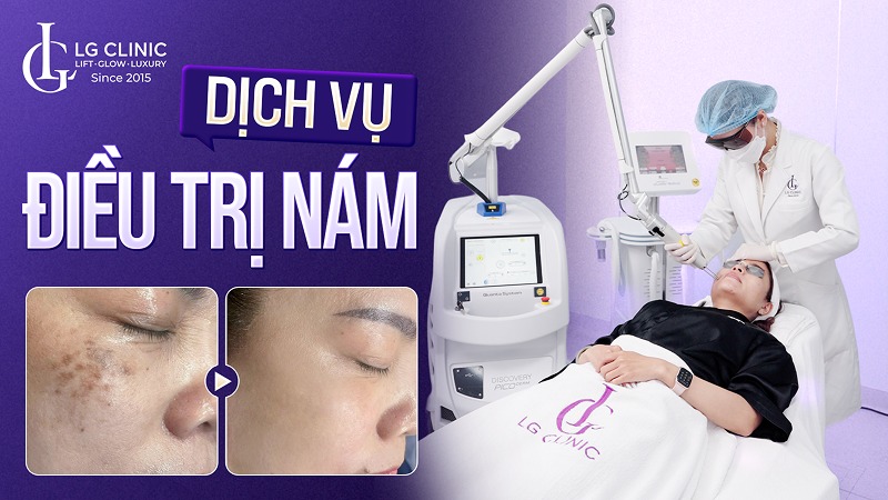 dịch vụ điều trị nám da