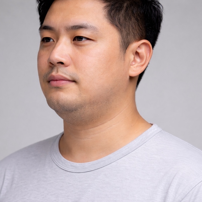 nọng cằm ở nam