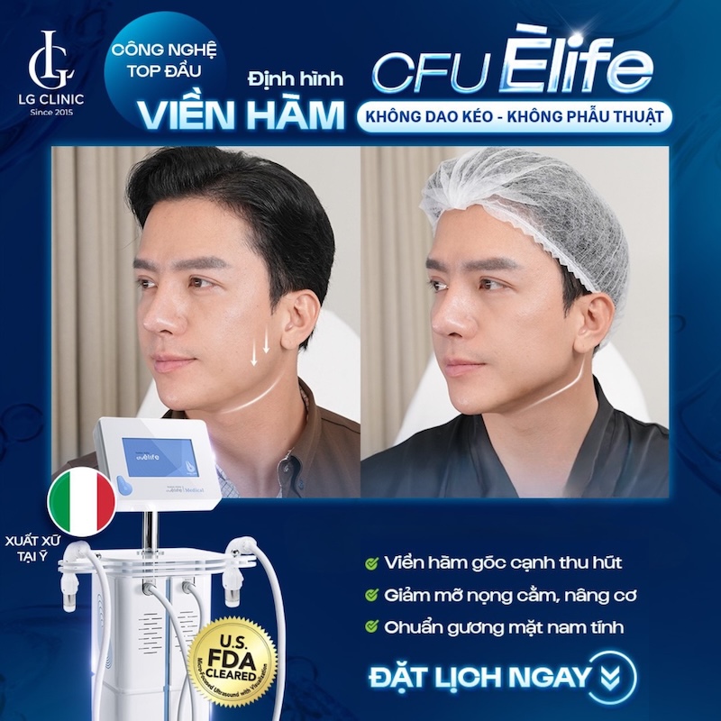 giảm nọng cằm cho nam