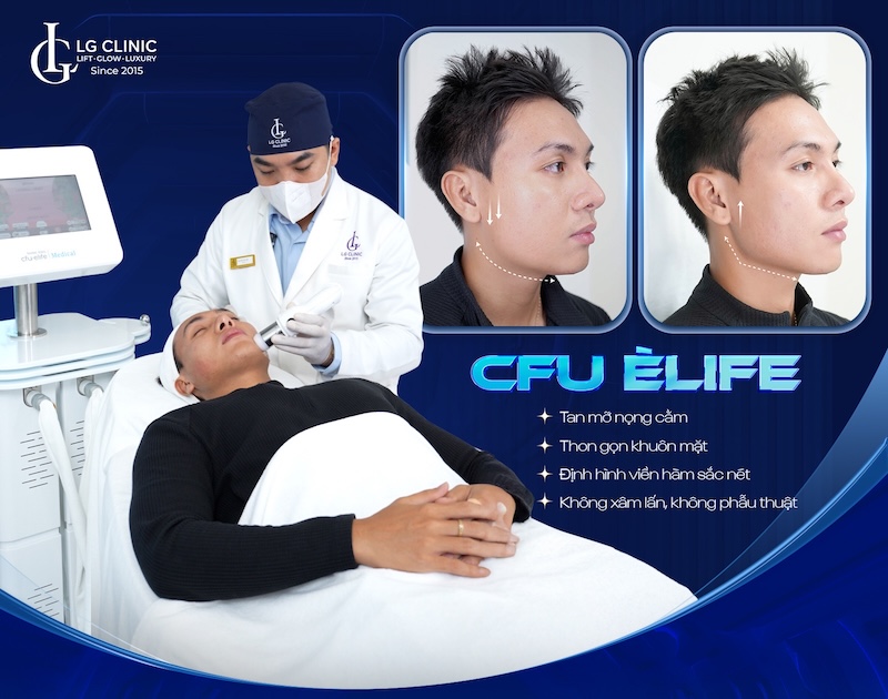 giảm nọng cằm cho nam