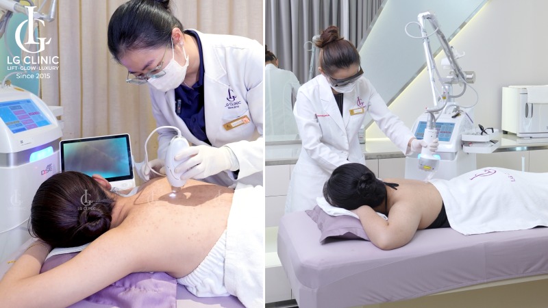 gynofar trị mụn lưng