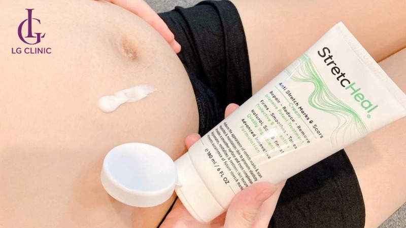 kem trị rạn da cho bà bầu