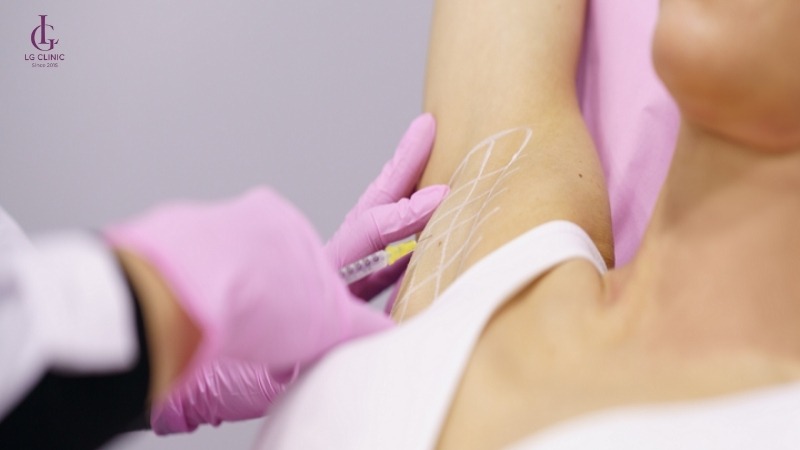 Làm sao để biết mình có bị hôi nách không