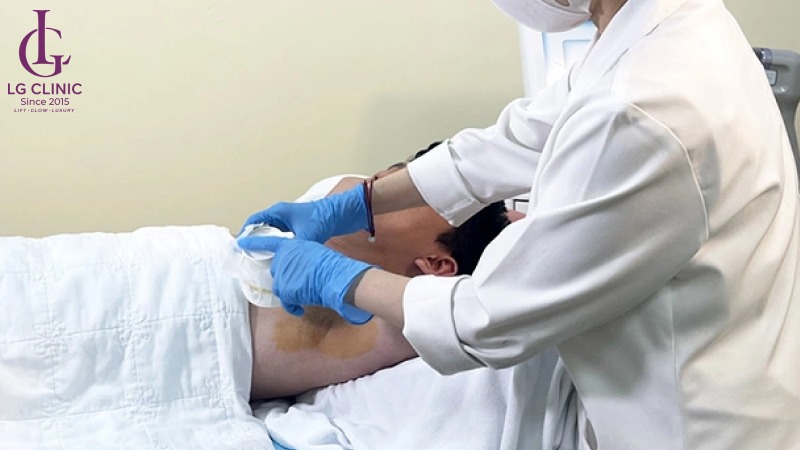 Làm sao để biết mình có bị hôi nách không