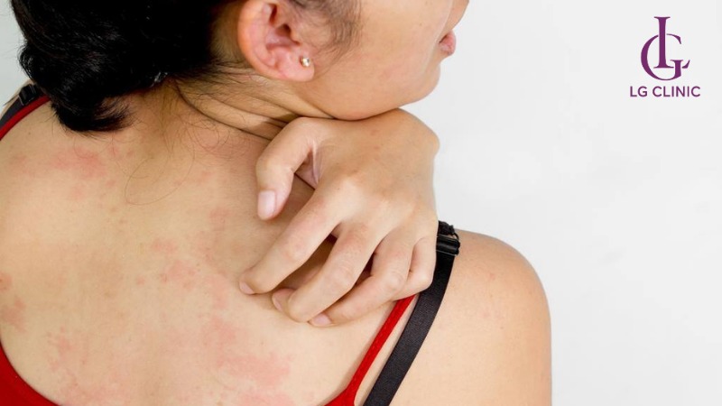 Lột da bao lâu thì được tắm trắng