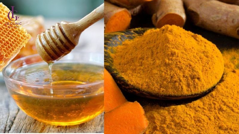 mụn ở nách nặn ra có mùi hôi​