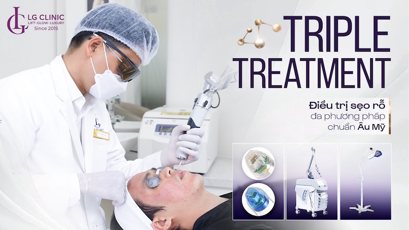 trị sẹo rỗ triple treatment