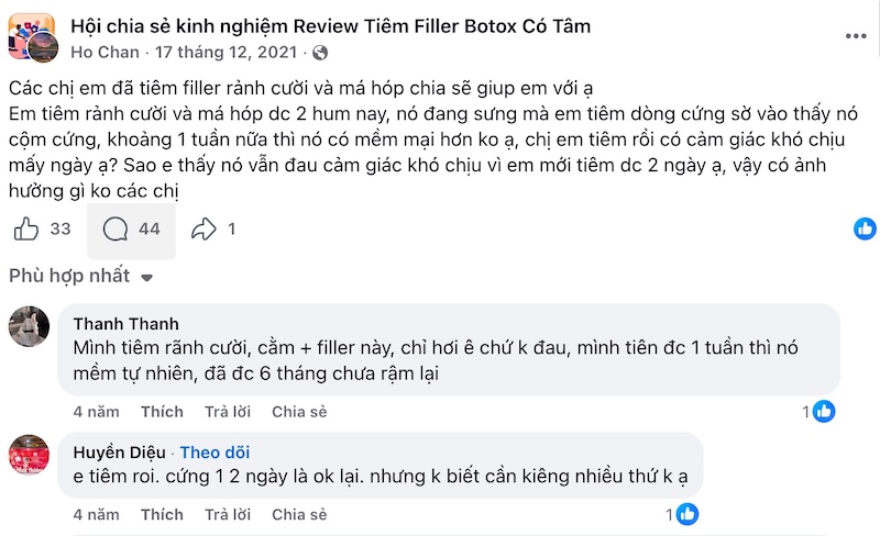 review tiêm rãnh cười