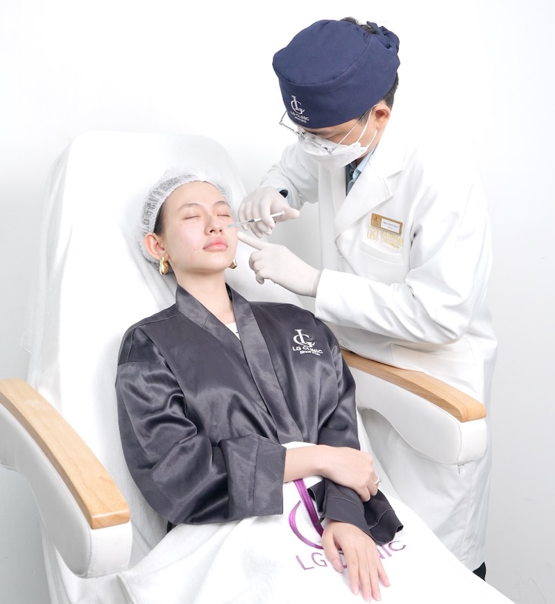 tiêm ha làm đầy rãnh cười