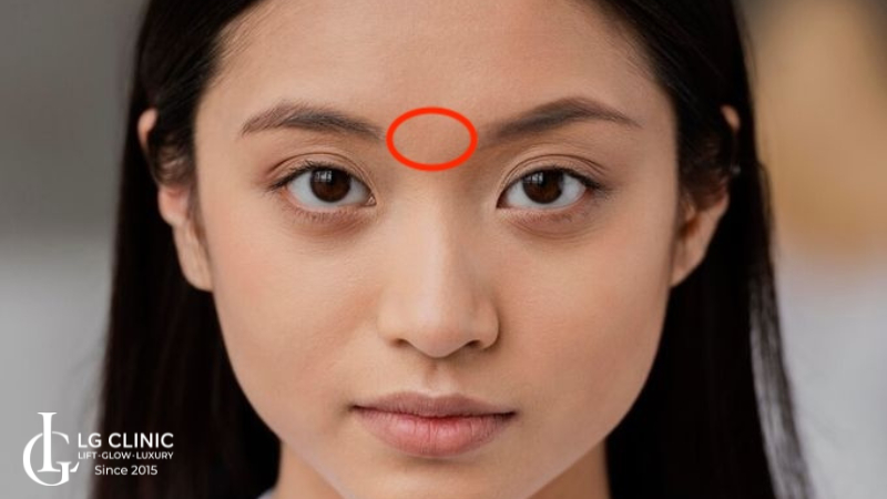 Ấn đường là gì? Vị trí ấn đường ở đâu?