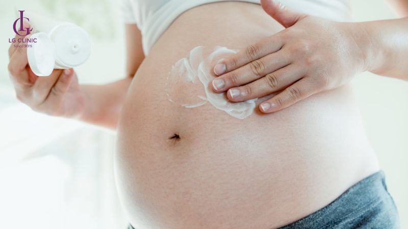 cách trị rạn da tại nhà