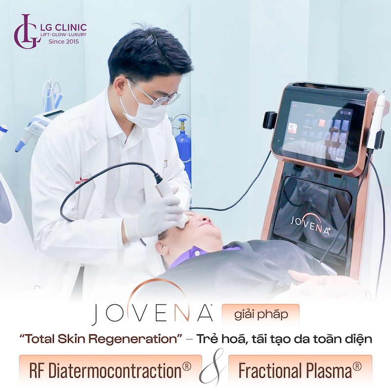 jovena