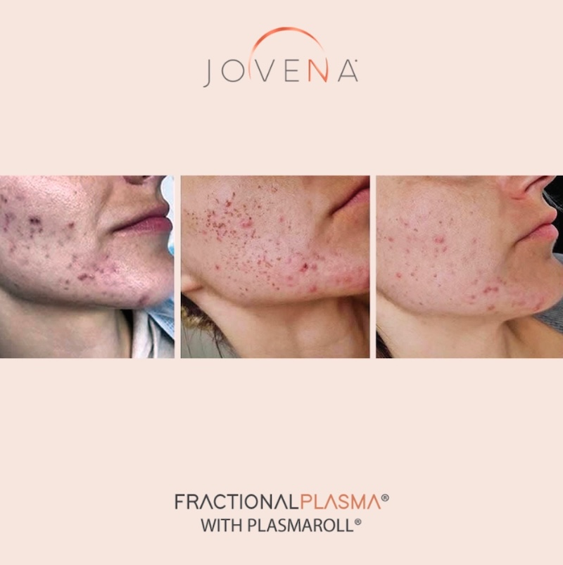 jovena