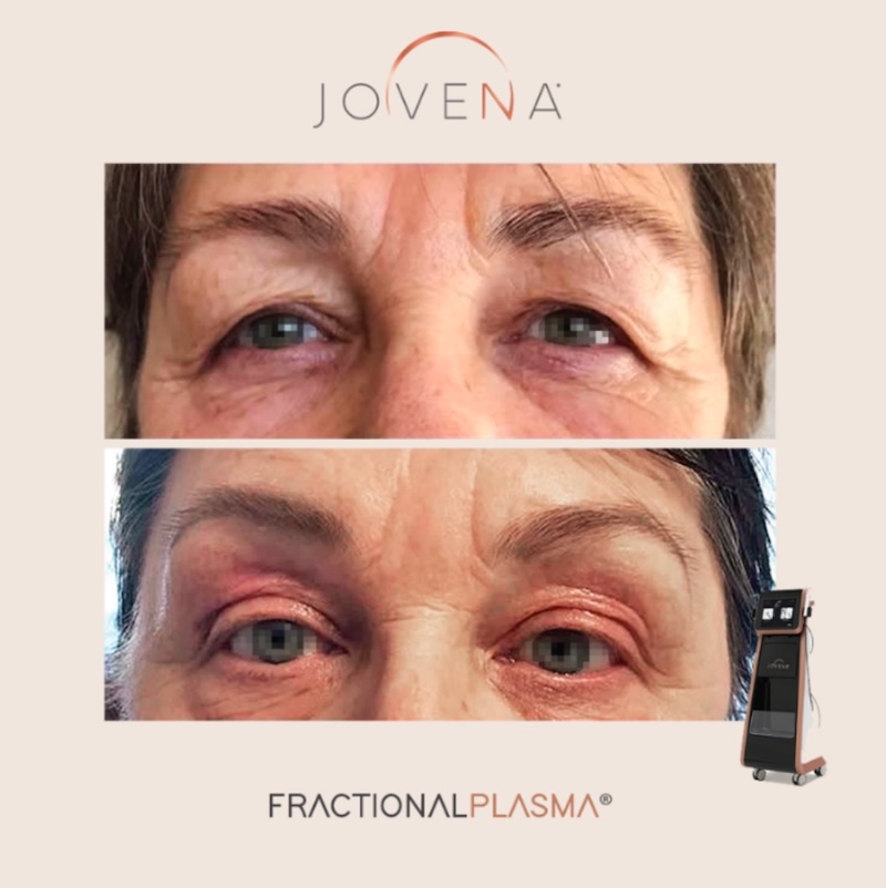 jovena