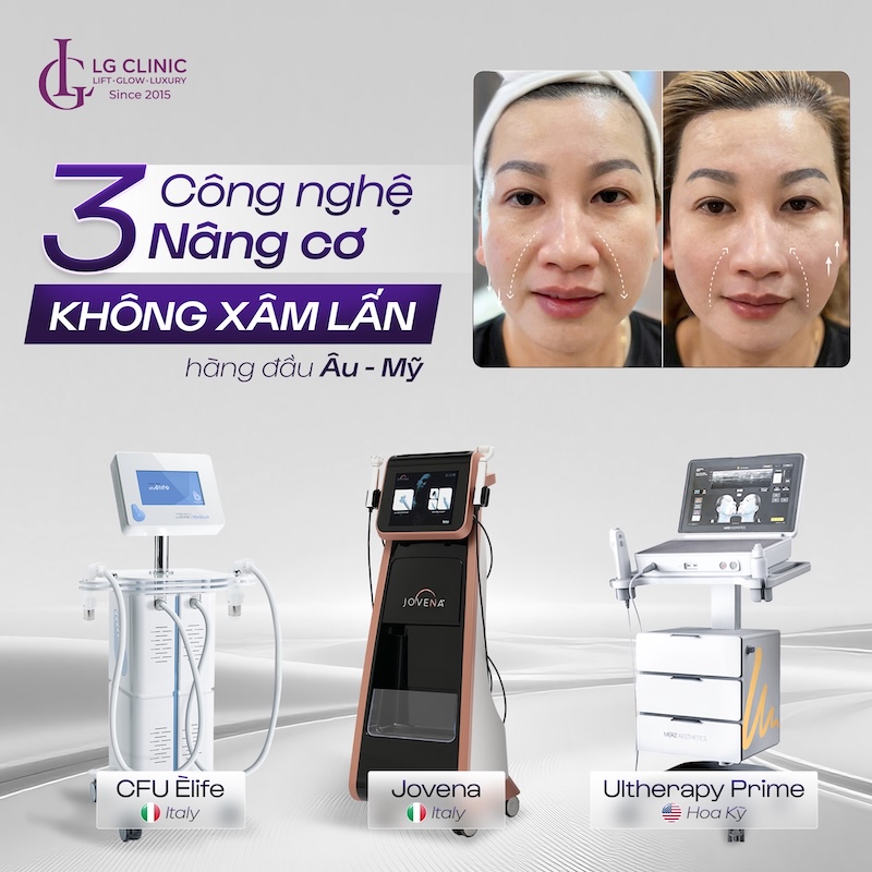 công nghệ nâng cơ không xấm lấn