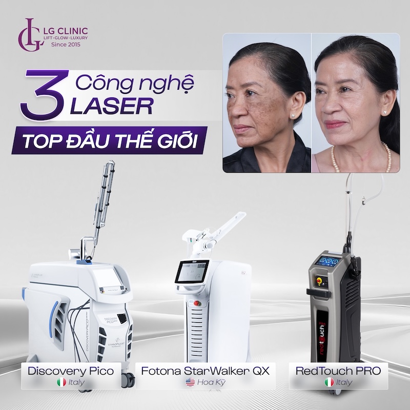 công nghệ laser điều trị sắc tố và trẻ hoá da
