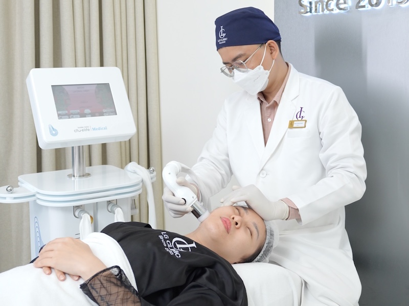 xoá nhăn cằm bằng cfu èlife