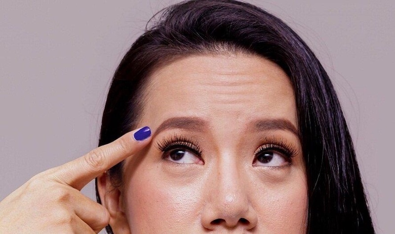 nếp nhăn trên trán