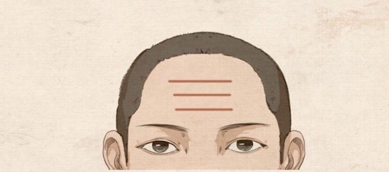 3 nếp nhăn ngang trán