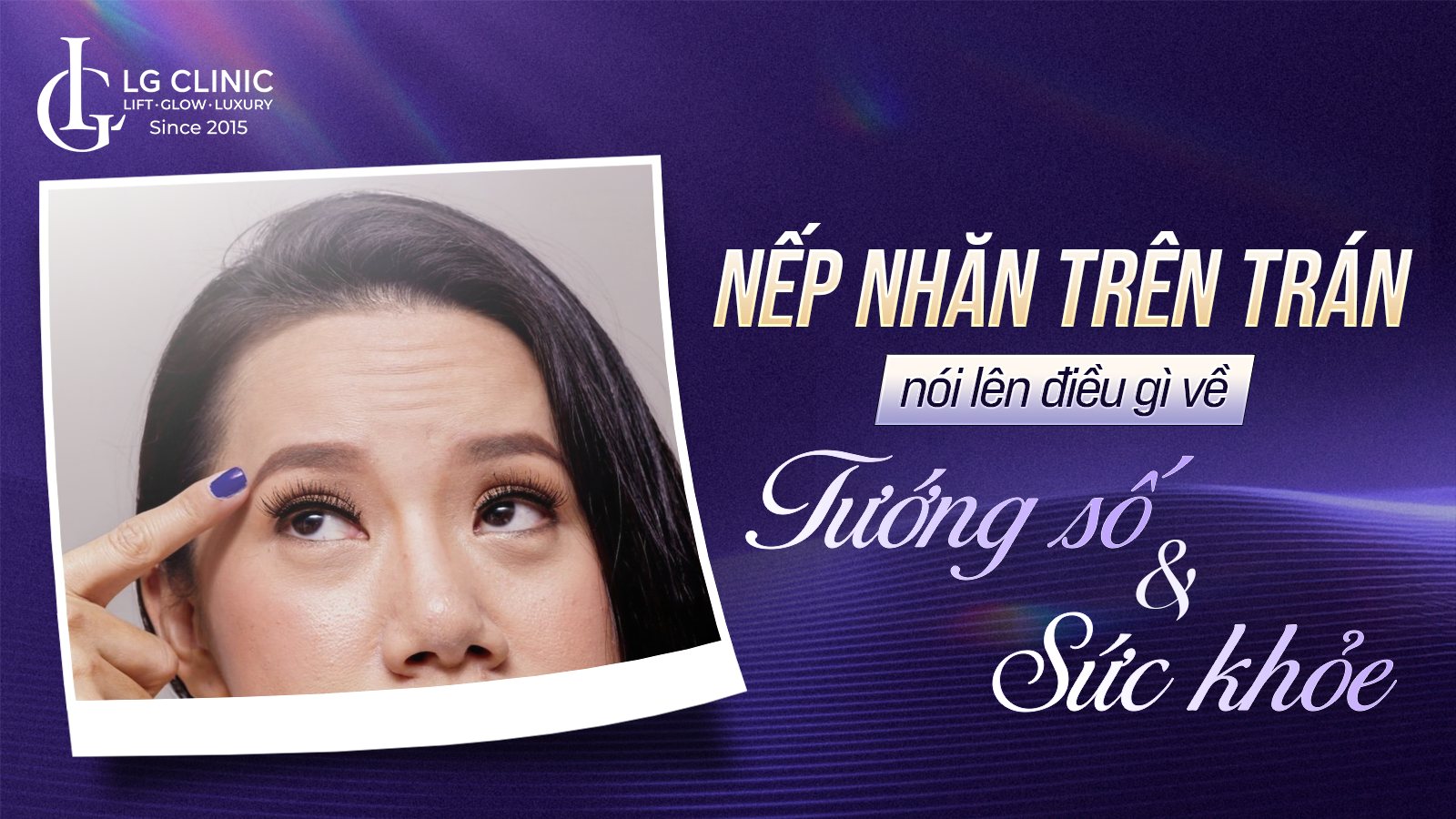 Nếp nhăn trên trán nói lên điều gì?