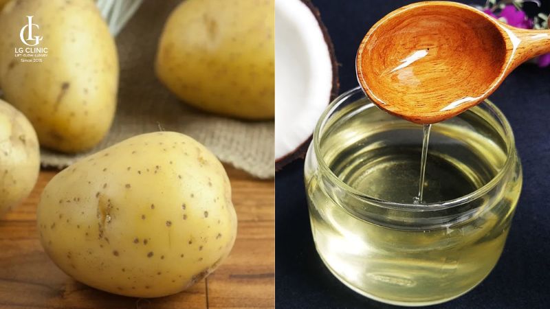 rạn da có chữa được không
