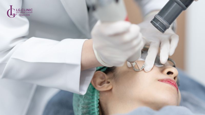 trị nám bằng laser bao nhiêu tiền
