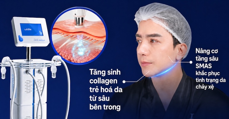 nâng cơ bằng cfu