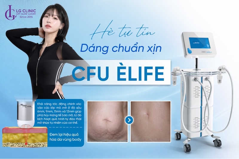 giảm béo không xâm lấn bằng cfu èlife