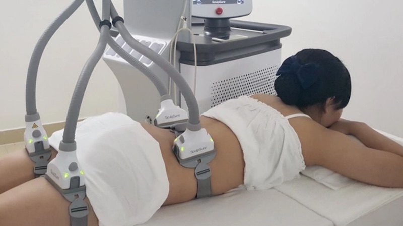 giảm mỡ không xâm lấn