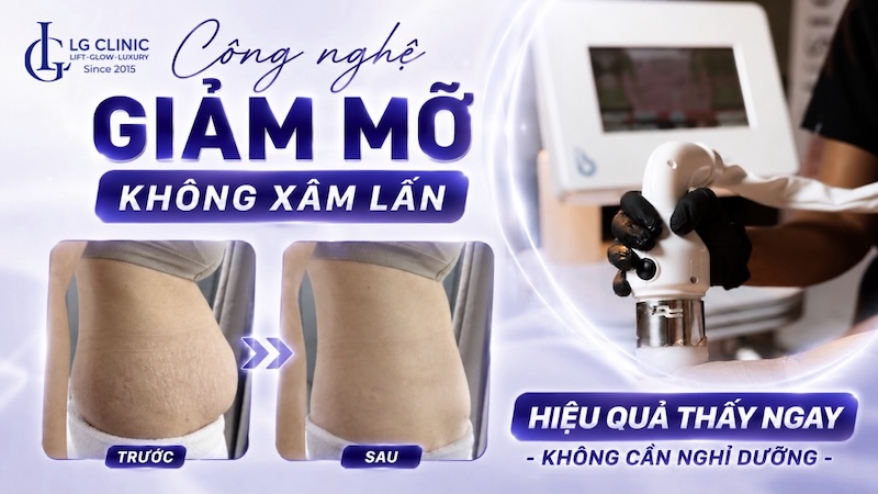 công nghệ giảm mỡ không xâm lấn