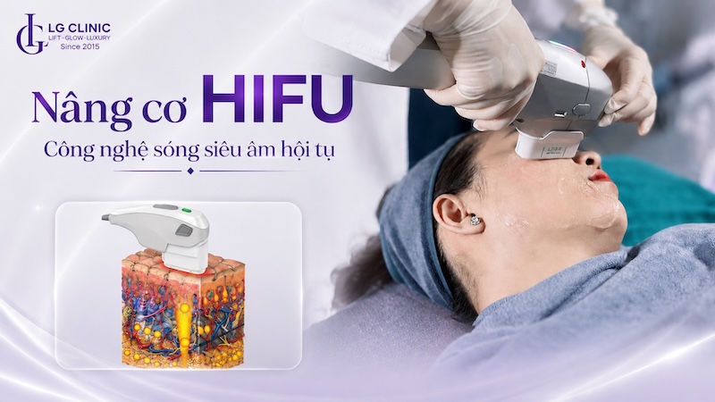 nâng cơ hifu